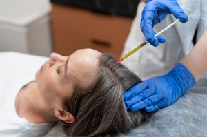Farewell to Hair Woes: PRP Hair Treatment in Birmingham Revealed